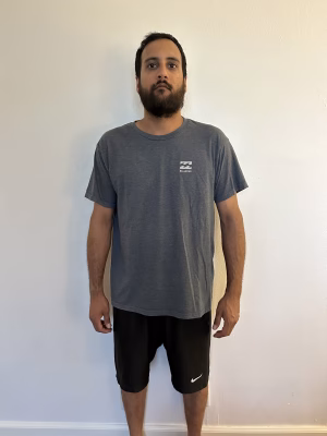 Neal Radia - Gallery Image 2