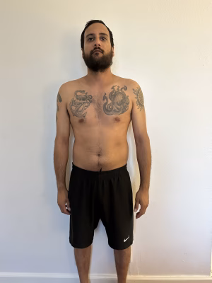 Neal Radia - Gallery Image 1