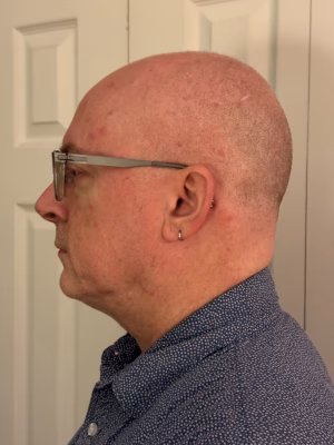 Timothy King - Gallery Image 2